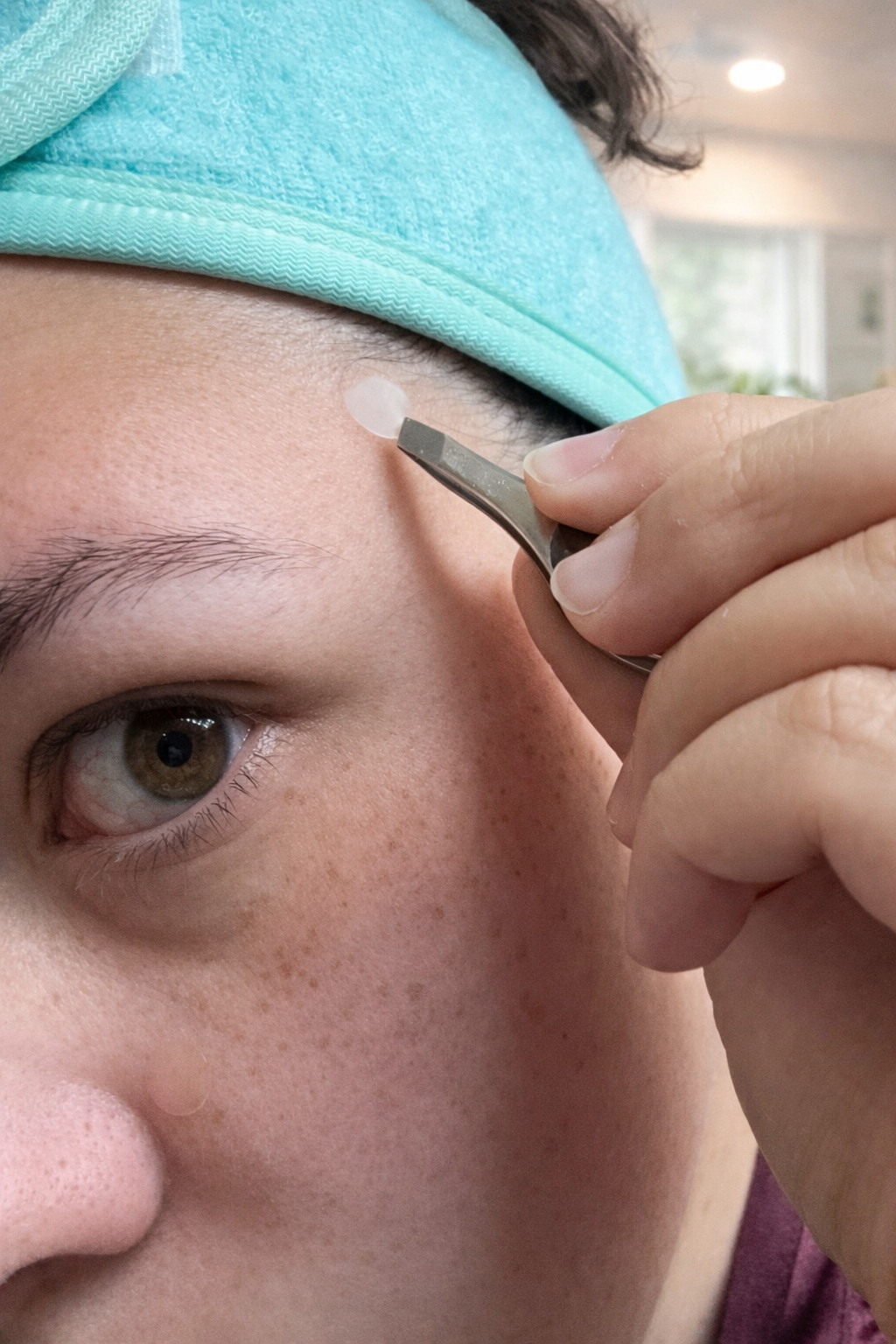 Stop Picking Your Pimples, Fix Them Overnight!